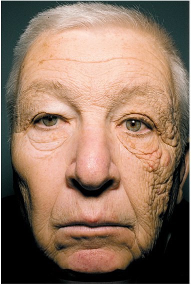 UVA damaged truck-driver